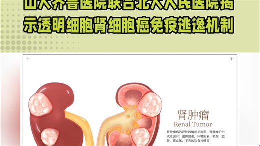 IF 14.1│ 山大齐鲁医院联合北大人民医院揭示SMYD3-SREBP1-CD47轴促进透明细胞肾细胞癌免疫逃逸机制