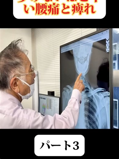 Chiropractic Techniques for Pain Relief and Posture Improvement