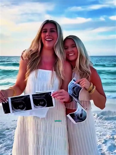 Two Best Friends, Same Pregnancy Surprise 🤰🤰#shorts