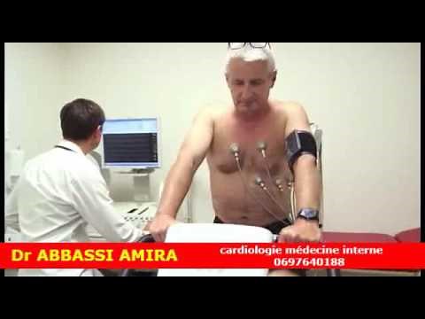 épreuve d'effort stress test