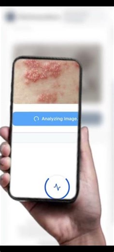SkinGuardians – AI Powered Skin Disease Detection App