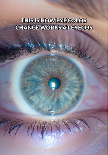 Transforming Brown Eyes to Blue: A Step-by-Step Guide