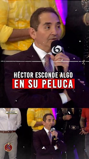 Héctor Garza ¿en escándalo por su peluca? 😱🤯🫣 #EsShow | Es Show