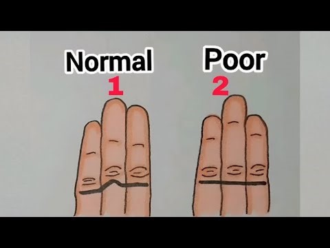 😵🧠WHAT IS YOUR STATUS 🧠😵