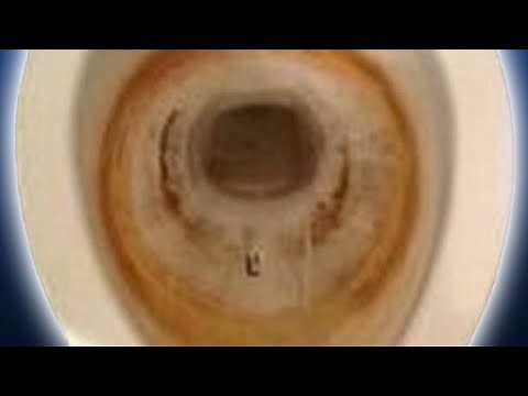 How To Get Rid of Toilet Stains [Pt 2] | How to Use Muriatic Acid to Clean Toilet Bowl HD