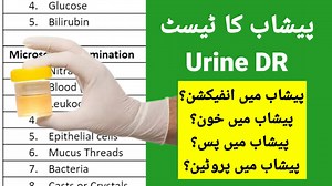 A urine test, also known as urinalysis, is a vital diagnostic tool used by healthcare professionals to assess various aspects of your health. This comprehensive guide will help you decipher the complexities of a urinalysis report, enabling you to gain valuable insights into your well-being. Learn to interpret key parameters such as color, appearance, pH levels, specific gravity, protein, glucose, ketones, bilirubin, urobilinogen, nitrites, leukocytes, and more. Discover the significance of each 