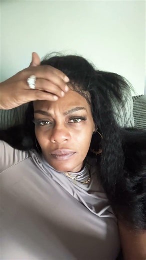 Dry skin tutorial #shortsviral #trendingshorts