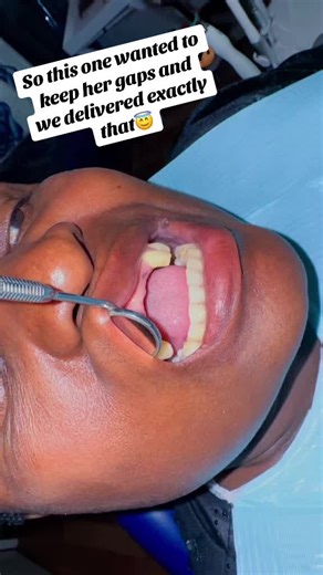 Mastering Denture Confidence: Embrace Your Unique Smile