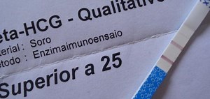 ما هو تحليل B-HCG - موضوع