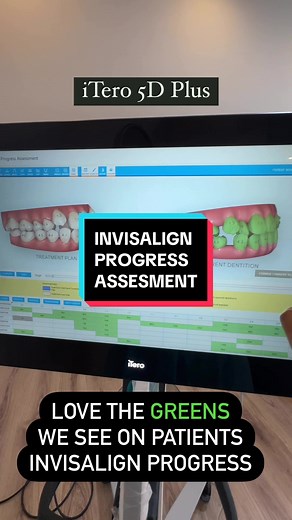 Invisalign Progress Assessments at Pallx Dental