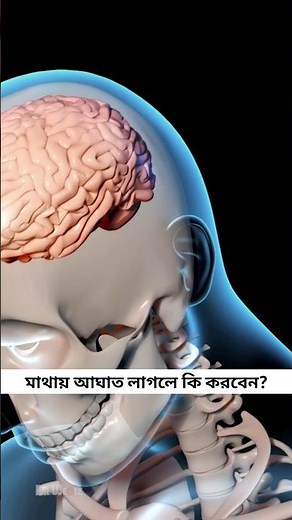 Head Injury