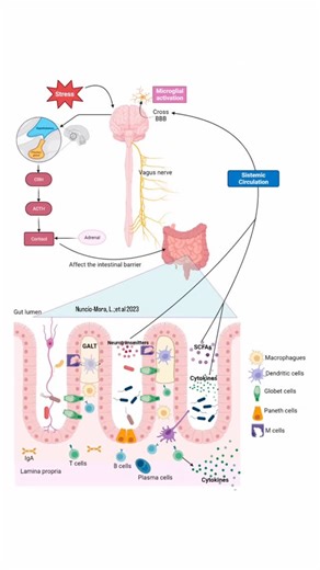 @biochemistry_nutrition_medlab on Instagram‎: "Brain-gut microbiome axis🧠Bidirectional communication of the microbiome with the brain through the immune system,vagus nerve,& neuroendocrine system. CRH,ACTH, gut-associated lymphoid tissue(GALT),SCFAs, IgA,BBB.It has been observed that there is bidirectional communication between the gastrointestinal tract & the brain in both healthy conditions & diseases.This network is called the gut-microbiota-brain axis.This bidirectional communication is exe