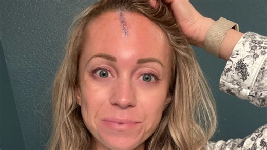 Rockies Reporter Kelsey Wingert Recovering After Taking Line Drive to the Head