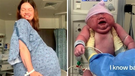 ‘Horrifying’: Giant newborn breaks record