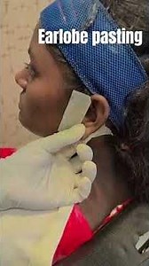 Earlobe pasting Trichy/ear hole treatment/ear piercing