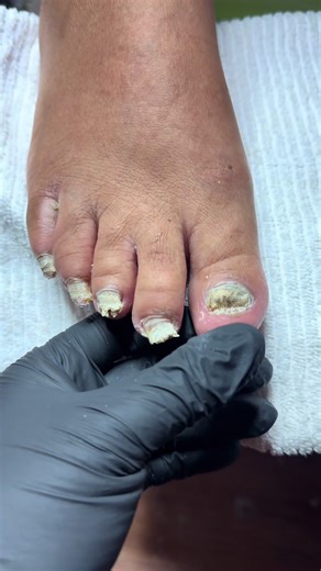 Leopard French #toesbykoki #toes #toebbl #pedicure #dallas #dfwtoes #dfwnails #winter #february #love #viral #pink #book #westdallas #oakcliff #fyp #valentine #paratii #expolre #leopard #cheater #cheetah