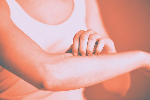 Here's the Real Reason Mosquito Bites Itch So Much