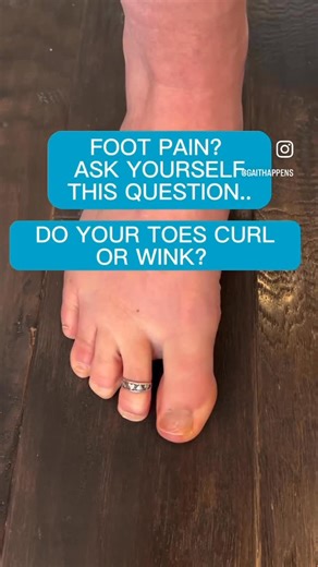 Gait Happens on Instagram: "Do your toes CURL or WINK? They better wink people, they better wink. Why? If not, here’s what could happen: 1. You have foot pain because your foot muscles are weak and aren’t engaging appropriately. 2. You fall a lot because weakness of your toes is one of the biggest predictor of falls as we age. 3. You have plantar ‘fasciitis’ because you don’t have stability of your forefoot at push off 4. You have metatarsal stress fractures because when your toes are weak they 