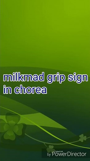 Milkmaid's grip sign in chorea