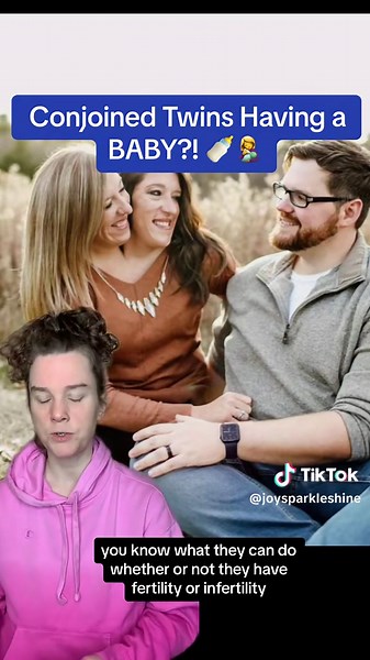 Conjoined Twins' Wedding & First Dance Sparks Viral Sensation