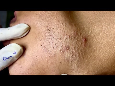 Satisfying video with Chung Vo Spa | 190
