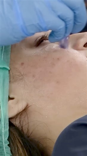 Benefits of Exosomes in Skincare Explained by Dr. Shaista Lodhi and Dr. Hira