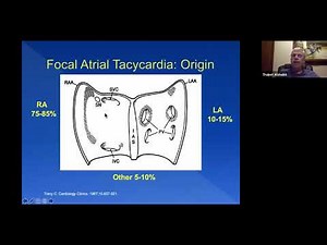From Surface ECG to Intracardiac EGM - Part 2