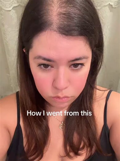 Revitalize Your Hair with Biotin and DHT Blocker Shampoo