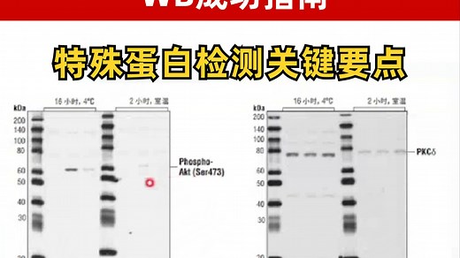 WB成功指南：特殊蛋白（大分子/小分子/膜蛋白/磷酸化）检测关键要点