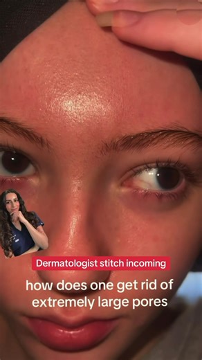 3 Simple Steps to Eliminate Large Pores