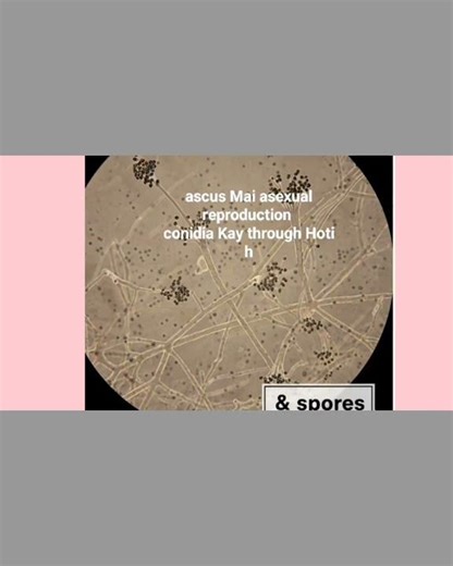 Ascomycota Explained | Sac Fungi Basics part 3 #biology #fungi