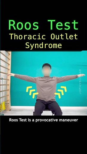 Roos Test. Thoracic Outlet Syndrome. #tos #brachialplexus #pulse