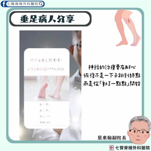 很多垂足的病人都會問：「醫師，我的腳還有可能再動嗎？」 - 垂足看起來只是「腳抬不起來」「腳踝無法活動」 但實際上走路時，病人會為了不絆倒，只能整隻腿往外甩🦵🏻 不只是走不穩，連 「我還能控制自己的腳嗎？」 這個念頭都會動搖😣 - 蔡醫師分享，這位病人術前，腳背完全抬不起來🆘 ✅來門診諮詢後決定手術！ 回診時，我們看到了一個很重要的瞬間！💥 他用力的時候，腳背真的抬起來了🥹🥹🥹 - 剛開始幅度不大，但對病人來說，那瞬間超有感😍 他說：「之前怎麼出力都是空的，現在有感覺了。」 - 🔅恢復不是一下子跳到終點 而是從「動了一點點」開始 🔅對我們來說，那個小小的抬腳， 就是神經回應的信號，也是信心回來的開始 ━━━━━━━━━━━━━━━━ 📍 高雄市新興區七賢一路420號 📞 掛號專線：07-2385878 📥 線上掛號：https://reurl.cc/QXzpQ5 🔗 更多資訊：https://www.spine.com.tw/ ━━━━━━━━━━━━━━━━ #垂足 #腓神經 #神經壓迫 #高雄脊椎 #蔡東翰醫師 #啄木鳥醫師 | 七賢脊椎外科醫院