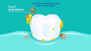 Sensodyne Pronamel Kids Toothpaste, Fluoride Anticavity Toothpaste, Cavity and Enamel Protection, for Ages 2+, Berry Twist Flavored, 4 oz (2 Pack)