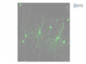 Whole Cell Recording from an Organotypic Slice Preparation of Neocortex