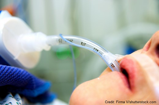 Glasgow Coma Scale (GCS) Assessment Nursing NCLEX Review