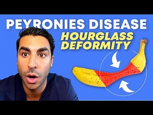 Peyronie’s Disease and Hourglass Deformity | Los Angeles Urology | Justin Houman MD Beverly Hills