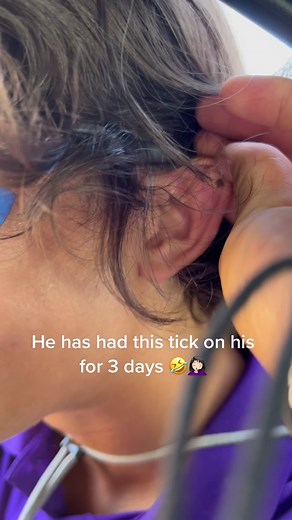 Adventures with @moosetorres14 #tick #eeww