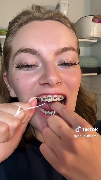 Braces Hygiene Routine with Effective Products