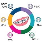 You Don't Have to Be a Genius to Choose Braces Colors
