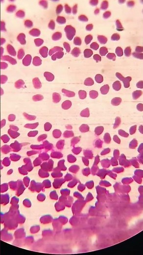 Microscopy | Peripheral blood smear preparation | Blood Smear | peripheral blood smear Hematology