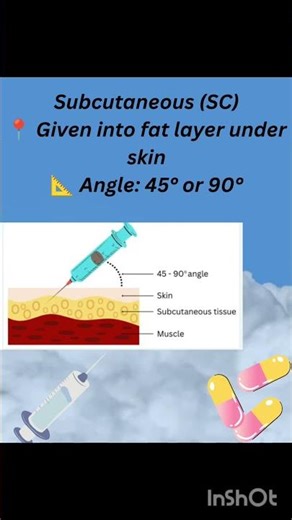 💉 Injection types and angles are important for safe drug administration.Every nursing student should
