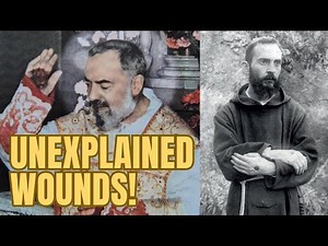 They Bled Like Christ — And No One Could Explain It