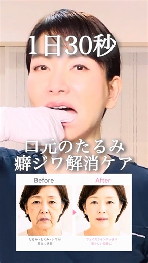 口元のたるみ癖シワ解消ケア #たるみ #しわ