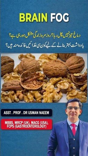 Brain Not Working Properly? Best Foods to Improve Memory and Mental Sharpness