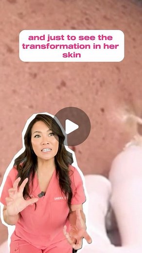 Sandra Lee, MD, FAAD, FAACS on Instagram: "We all know her and LOVE her for her fantastic pops and lively personality, Momma squishy ⁠ ⁠ Binge the 13-video playlist on my YouTube channel  link in bio!⁠ ⁠ #drpimplepopper #popaholic"