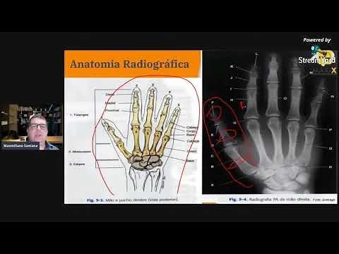INCIDÊNCIA PARA QUIRODÁCTILOS E ANATOMIA - DEDOS DAS MÃOS
