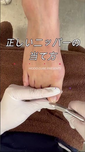 正しいニッパーの持ち方 #巻き爪 #肥厚爪 ＃治療