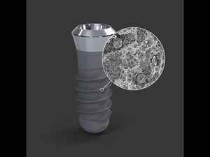 Straumann® Tissue Level Implant System