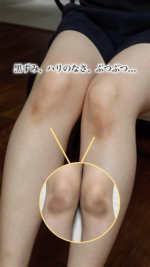 【検証】ひじ・ひざの黒ずみ・ブツブツにレチノールミストを使い続けた結果...！